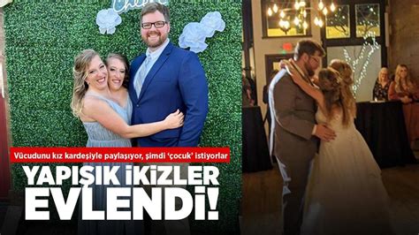 Yapışık ikizler evlendi